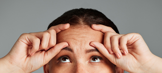 What Causes Forehead Wrinkles?