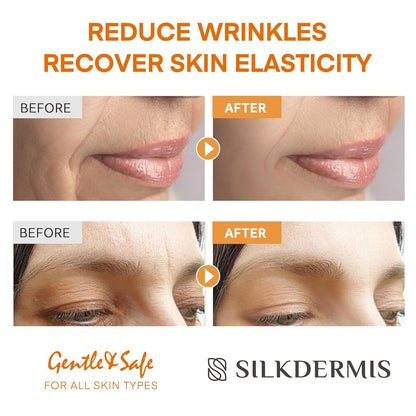 Forehead Wrinkle Patches with Triangle: For Smile Line and Under Eye-Anti Wrinkle Patches with Aloe, Collagen, Vitamin E 112pcs