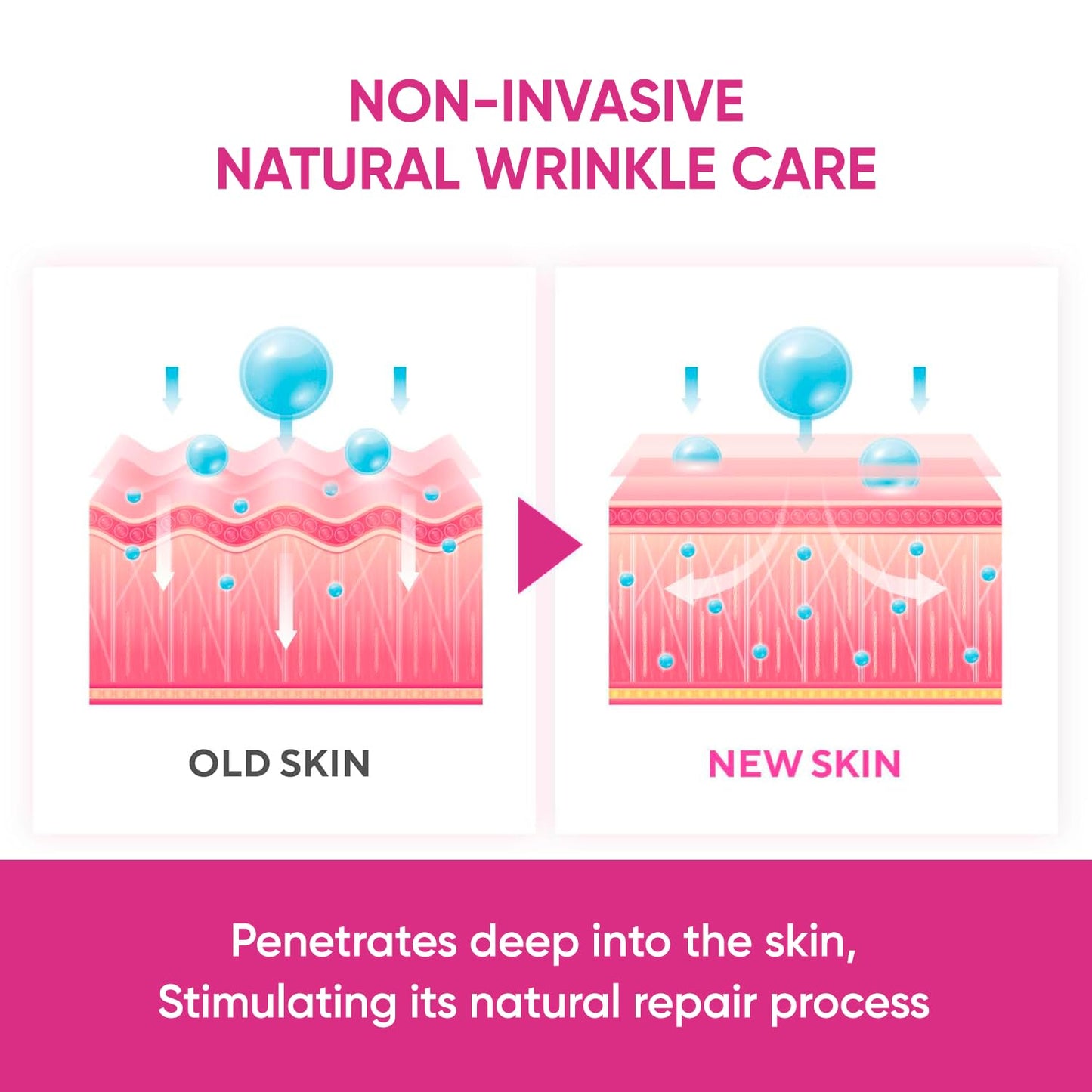 Anti Forehead Wrinkle Patches: Anti Wrinkle Facial Patches overnight- Forehead Wrinkles Treatment 144 pcs