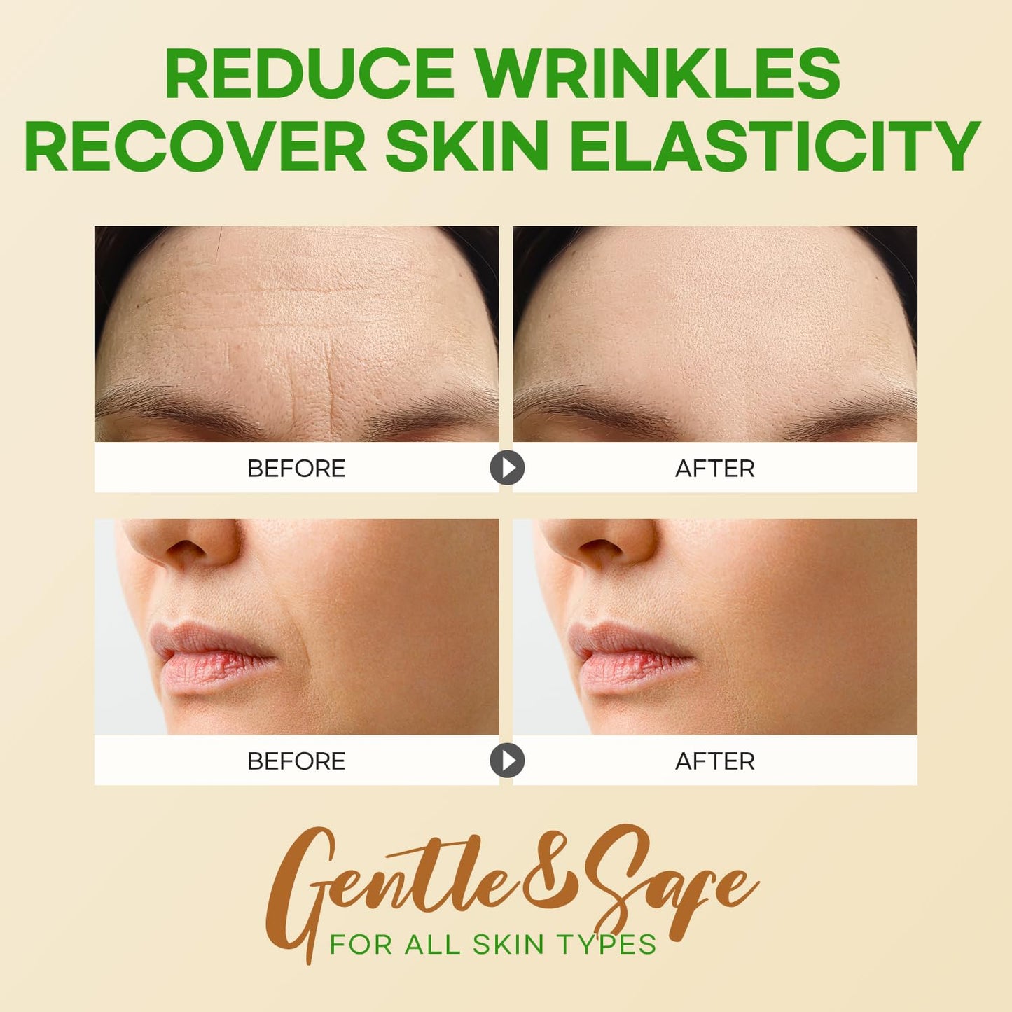 Hydrating Forehead & Smile Line Patches – Aloe, Collagen & Vitamin E (36pcs Set)